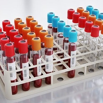 Recoltare analize - Centrul Medical Dr. Luca-Maria Giroc